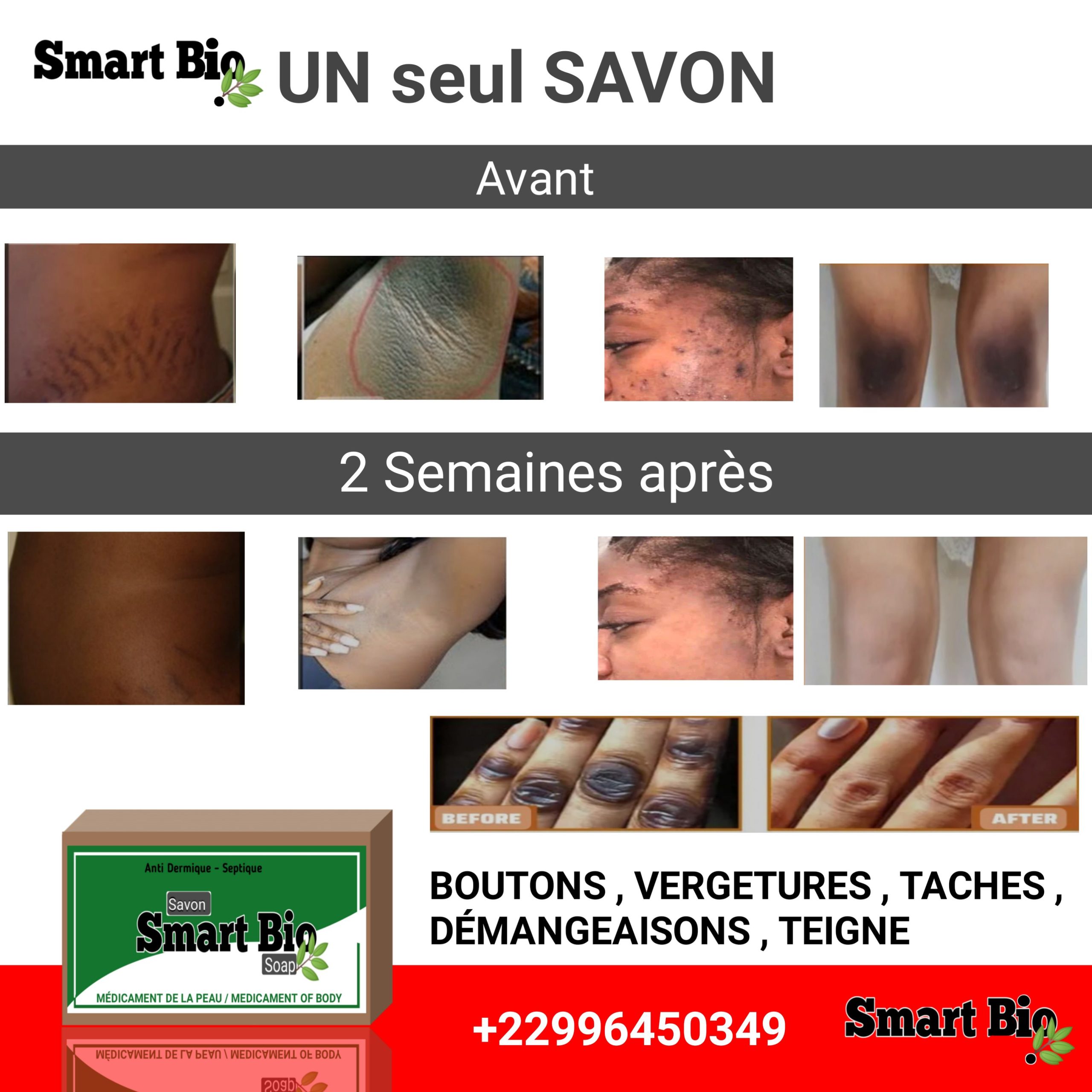 Savon